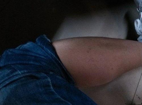 脚肚子照片,探寻足部健康与美丽之道